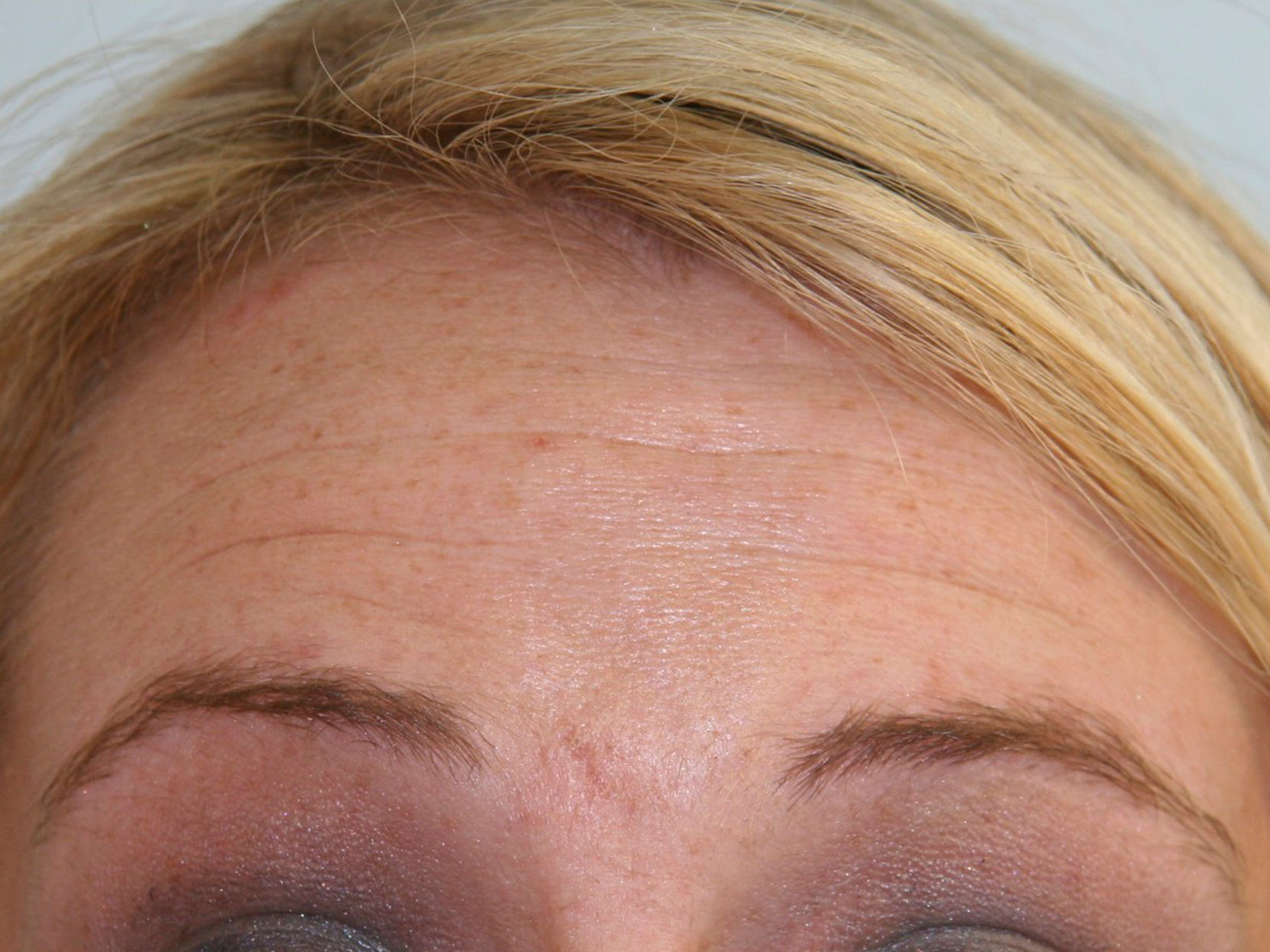 Pediatric Before & After Photo #1